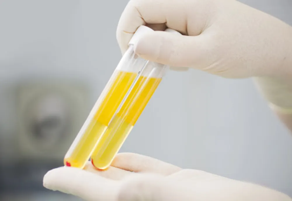 Peste 2.500 de români vindecați de COVID au donat plasmă pentru salvarea pacienților infectați