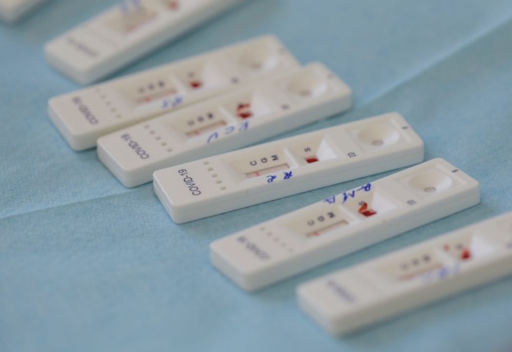 România va produce teste rapide pentru depistarea anticorpilor COVID-19