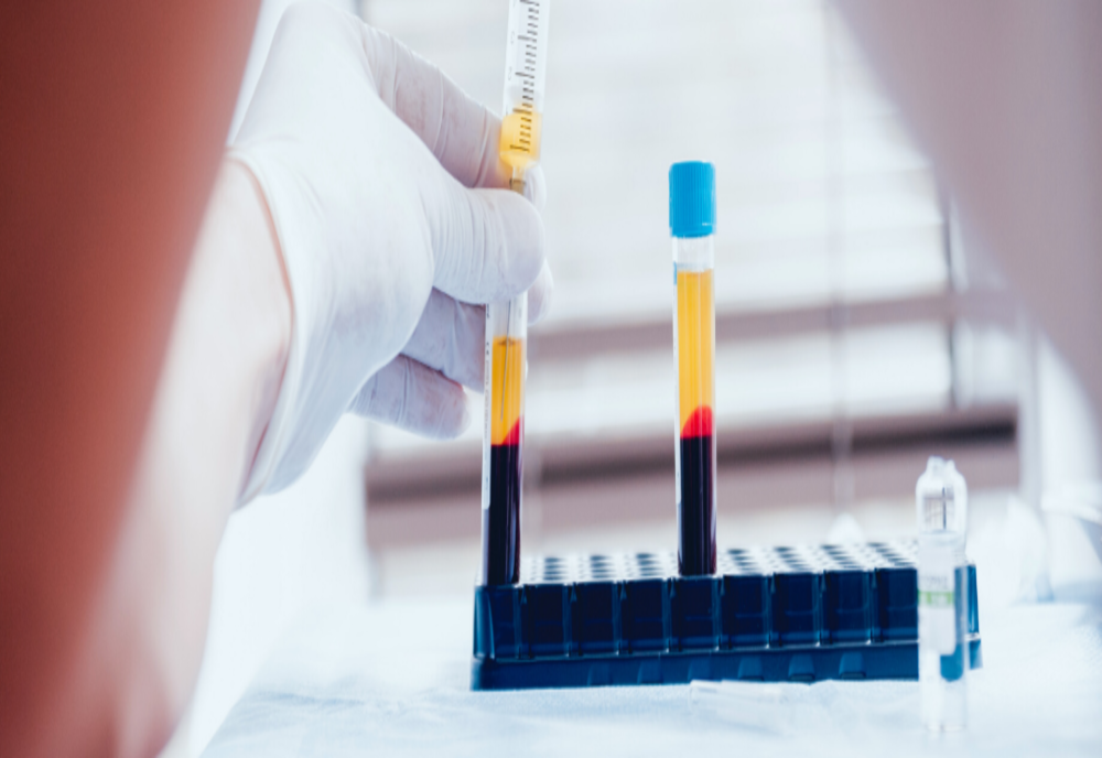 Acordarea stimulentului financiar de 1000 de euro pentru donatorii de plasmă, adoptată de CGMB