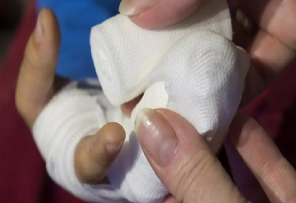 Scandal la cel mai mare spital de copii din România! Spitalul „Grigore Alexandrescu” riscă să piardă finanțarea de la Banca Mondială pentru marii arși