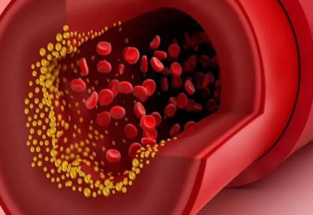 Cum contribuie stresul la creșterea colesterolului?