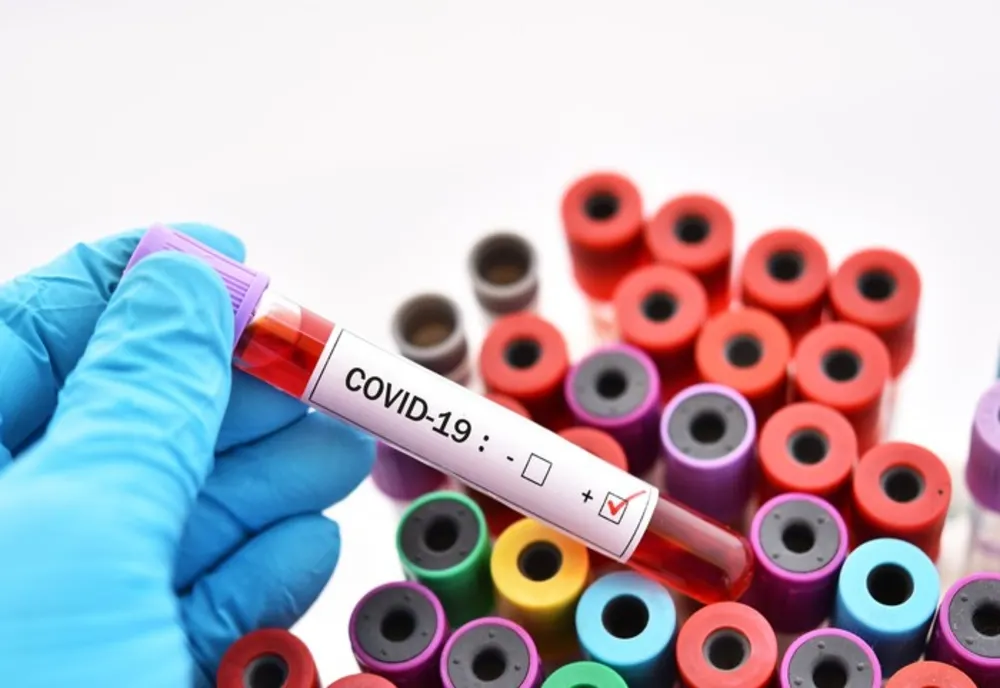 Coronavirus, nou raport: 420 de bolnavi și 21 de decese, în 24 de ore/ Capitala se află pe locul doi la îmbolnăviri
