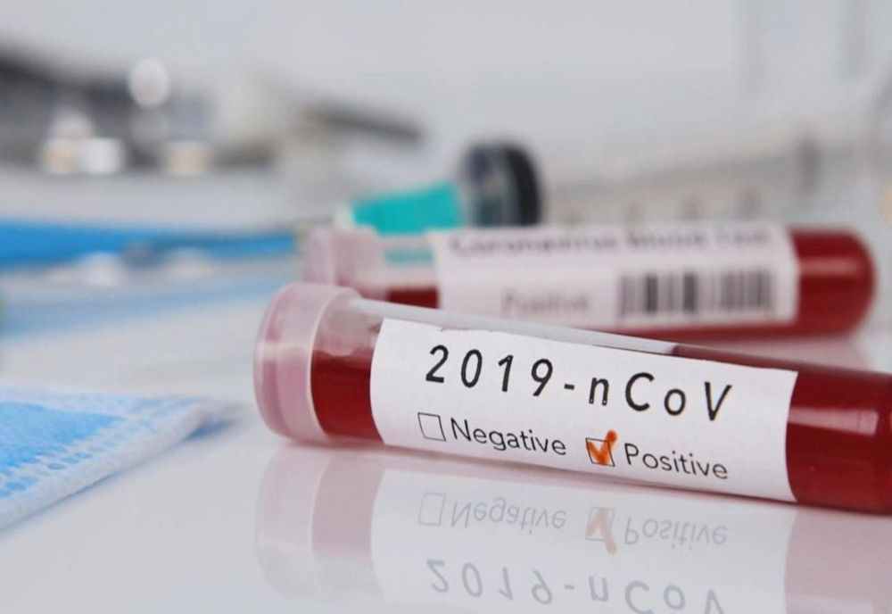 Încă trei suceveni au murit de coronavirus