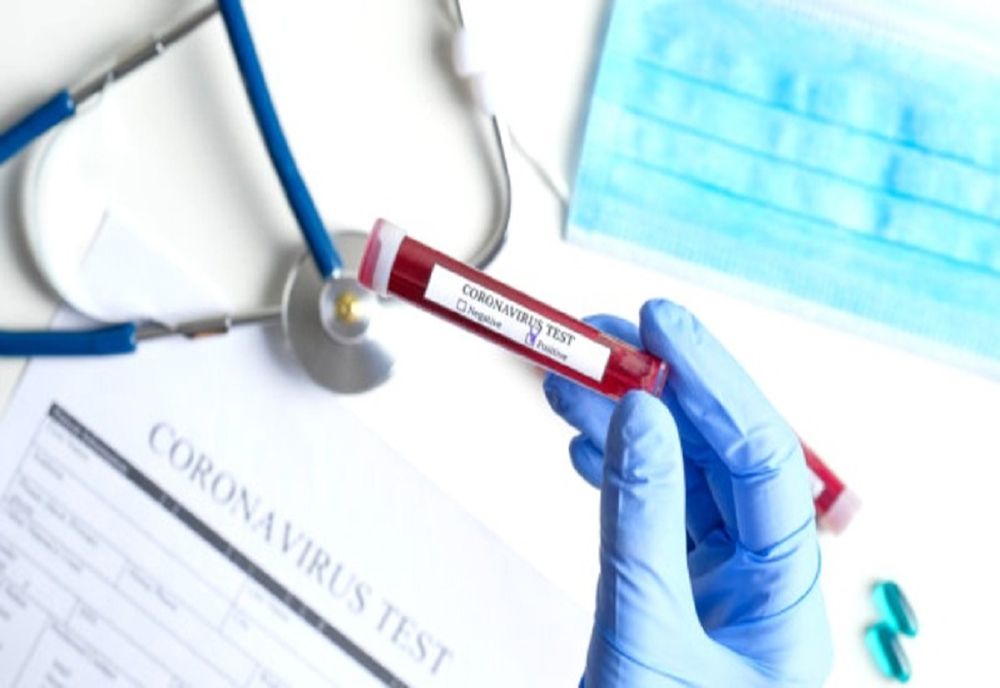 Până astăzi, 2 mai, pe teritoriul României, au fost confirmate 12.732 de cazuri de persoane infectate cu virusul COVID – 19