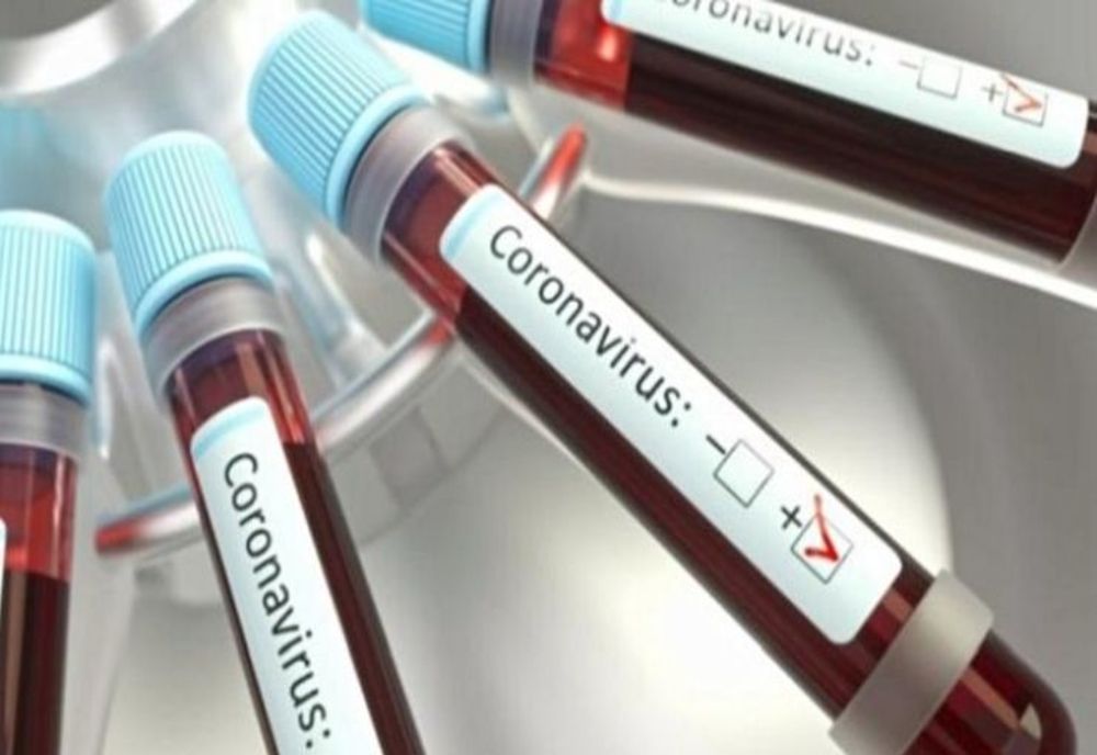 CORONAVIRUS ROMÂNIA: 187 de cazuri noi de coronavirus în ultimele 24 de ore