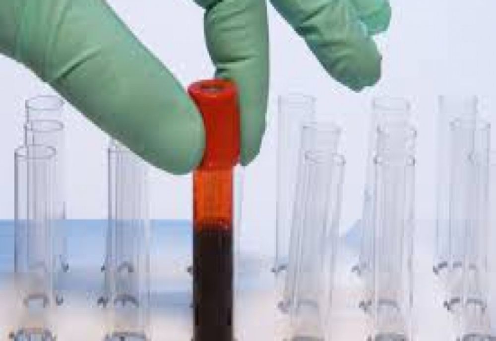 CRIZA de imunoglobulină, în atenția Ministerului Sănătății