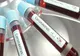 Bilanț coronavirus România: 275 de cazuri noi de infectare și 14 decese în ultimele 24 de ore
